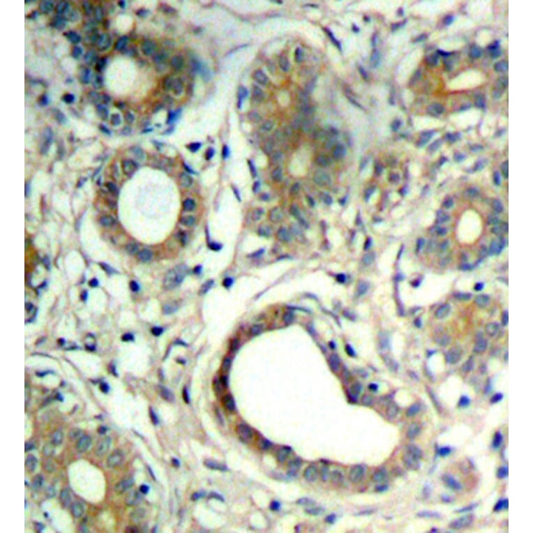 Immunohistochemistry - Anti-PTPN11 (phospho Y580) Antibody (AP0439) - Antibodies.com
