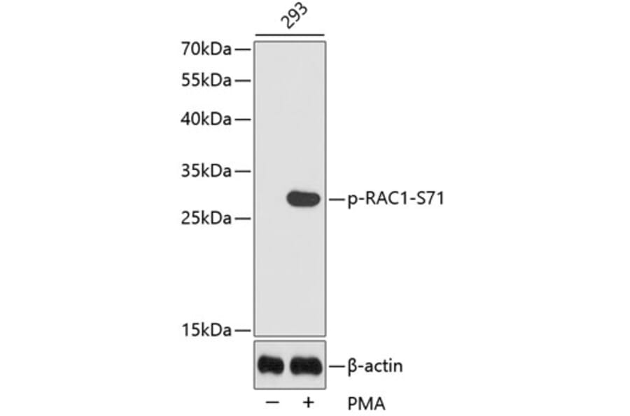 Western Blot - Anti-RAC1 (phospho S71) Antibody (AP0442) - Antibodies.com