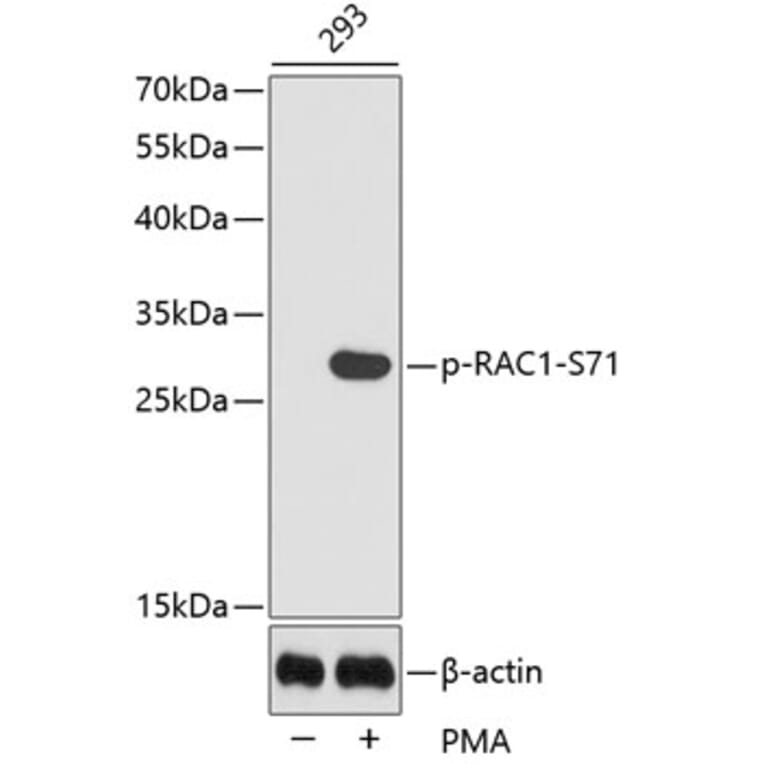 Western Blot - Anti-RAC1 (phospho S71) Antibody (AP0442) - Antibodies.com