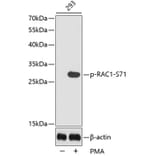 Western Blot - Anti-RAC1 (phospho S71) Antibody (AP0442) - Antibodies.com