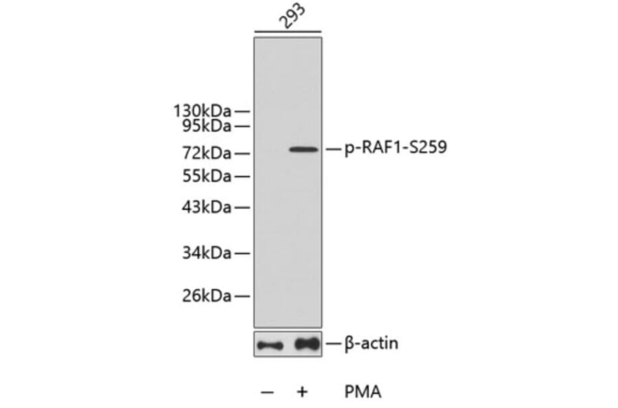Western Blot - Anti-RAF1 (phospho S259) Antibody (AP0443) - Antibodies.com