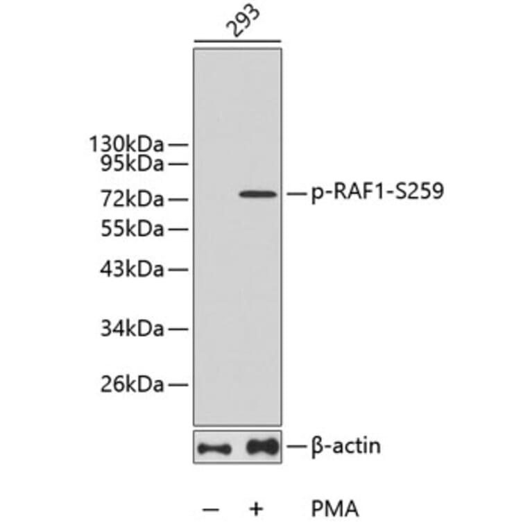 Western Blot - Anti-RAF1 (phospho S259) Antibody (AP0443) - Antibodies.com