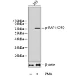Western Blot - Anti-RAF1 (phospho S259) Antibody (AP0443) - Antibodies.com