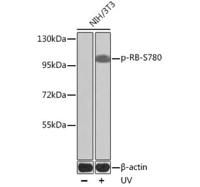 Western Blot - Anti-Rb (phospho Ser780) Antibody (A16661) - Antibodies.com