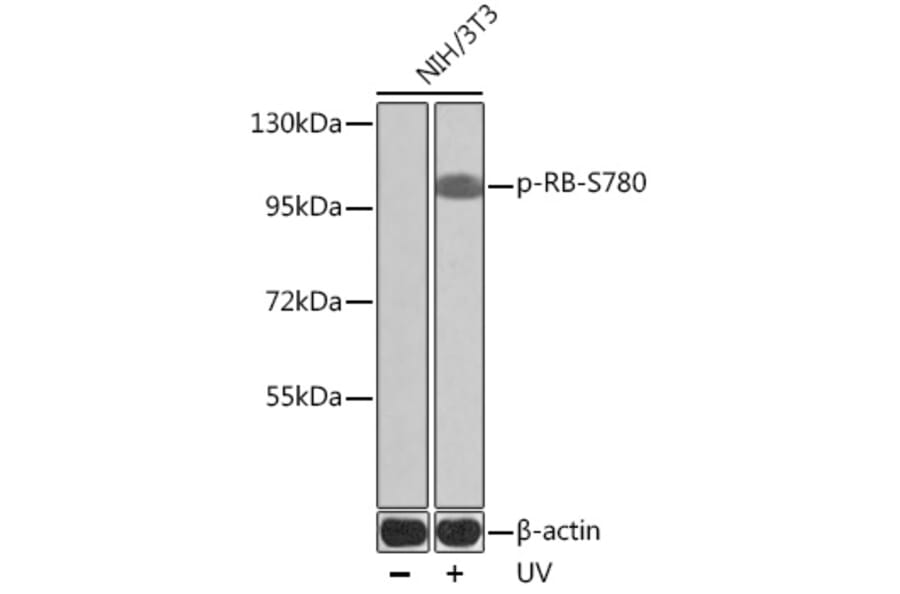 Western Blot - Anti-Rb (phospho Ser780) Antibody (A16661) - Antibodies.com