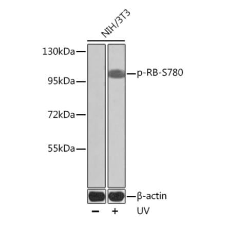Western Blot - Anti-Rb (phospho Ser780) Antibody (A16661) - Antibodies.com