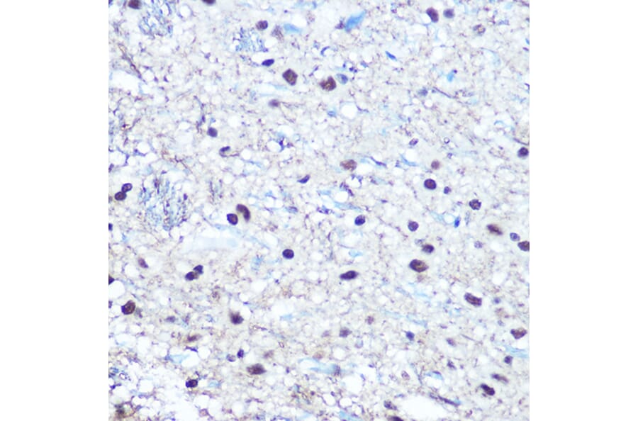 Immunohistochemistry - Anti-Rb (phospho Ser780) Antibody (A16661) - Antibodies.com