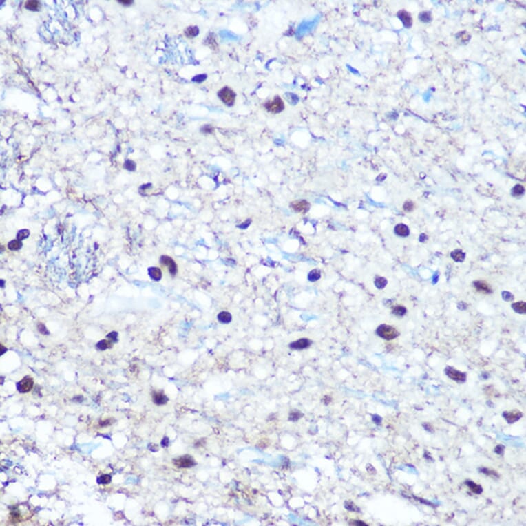 Immunohistochemistry - Anti-Rb (phospho Ser780) Antibody (A16661) - Antibodies.com