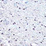 Immunohistochemistry - Anti-Rb (phospho Ser780) Antibody (A16661) - Antibodies.com