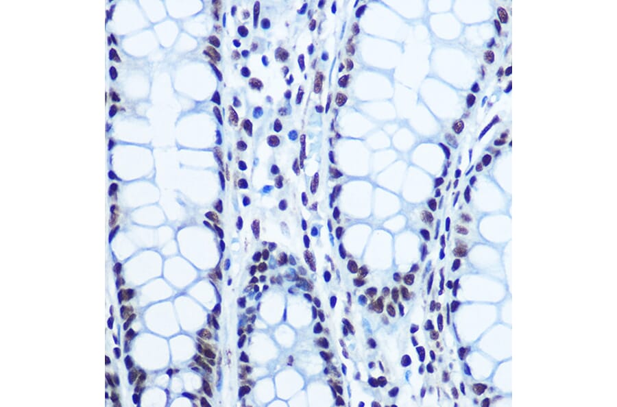Immunohistochemistry - Anti-Rb (phospho Ser780) Antibody (A16661) - Antibodies.com