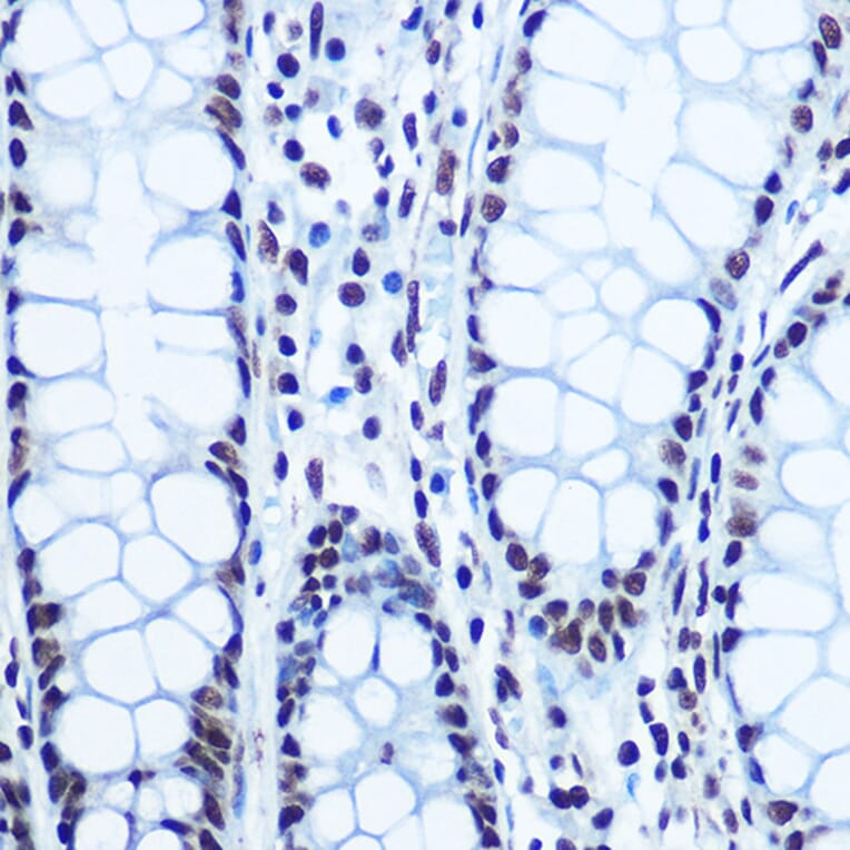 Immunohistochemistry - Anti-Rb (phospho Ser780) Antibody (A16661) - Antibodies.com