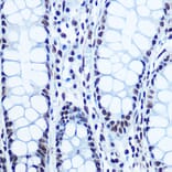 Immunohistochemistry - Anti-Rb (phospho Ser780) Antibody (A16661) - Antibodies.com
