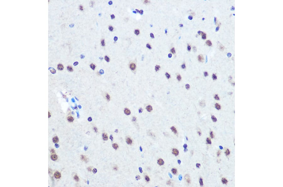 Immunohistochemistry - Anti-Rb (phospho Ser780) Antibody (A16661) - Antibodies.com