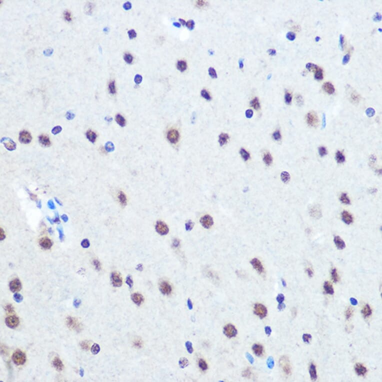 Immunohistochemistry - Anti-Rb (phospho Ser780) Antibody (A16661) - Antibodies.com