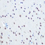 Immunohistochemistry - Anti-Rb (phospho Ser780) Antibody (A16661) - Antibodies.com