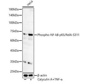Western Blot - Anti-NF-kB p65 (phospho Ser311) Antibody (A16662) - Antibodies.com