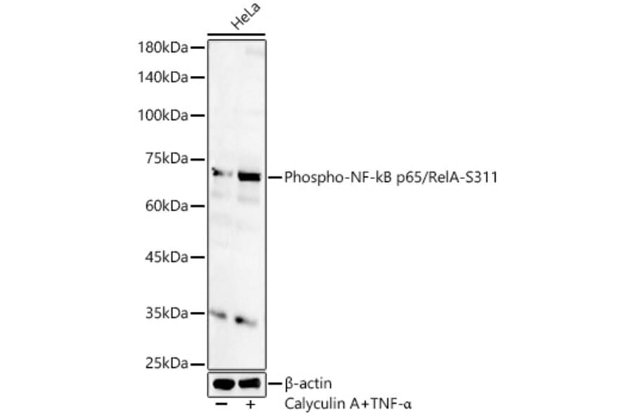 Western Blot - Anti-NF-kB p65 (phospho Ser311) Antibody (A16662) - Antibodies.com