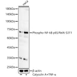 Western Blot - Anti-NF-kB p65 (phospho Ser311) Antibody (A16662) - Antibodies.com