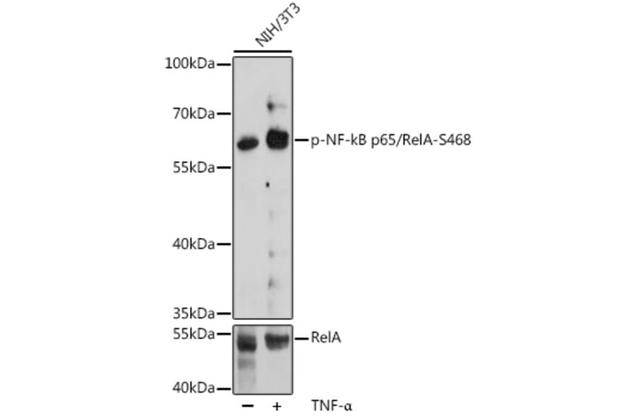 Western Blot - Anti-NF-kB p65 (phospho Ser468) Antibody (A16663) - Antibodies.com