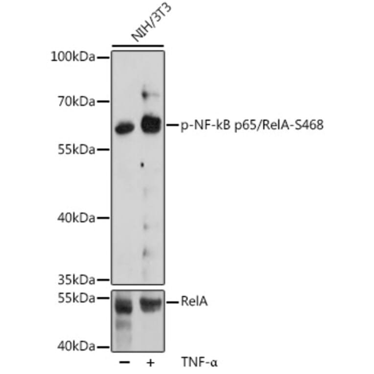 Western Blot - Anti-NF-kB p65 (phospho Ser468) Antibody (A16663) - Antibodies.com