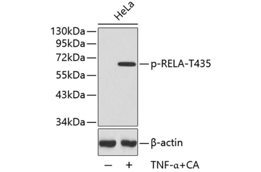 Western Blot - Anti-RELA (phospho T435) Antibody (AP0447) - Antibodies.com
