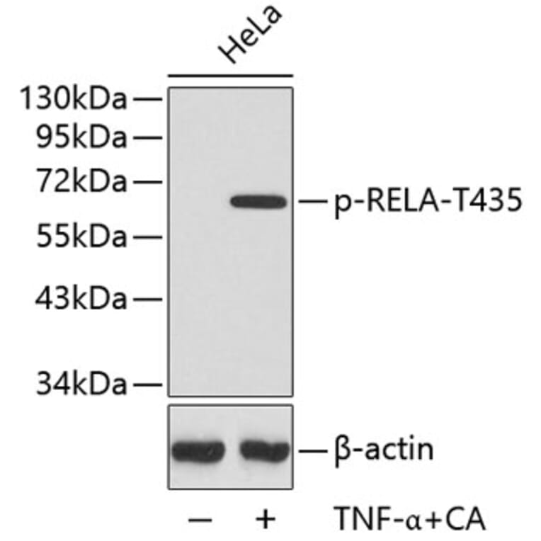 Western Blot - Anti-RELA (phospho T435) Antibody (AP0447) - Antibodies.com