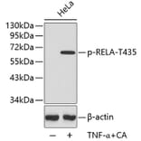 Western Blot - Anti-RELA (phospho T435) Antibody (AP0447) - Antibodies.com