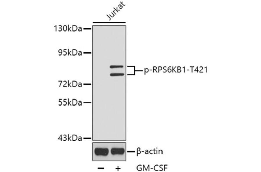 Western Blot - Anti-RPS6KB1 (phospho T421) Antibody (AP0449) - Antibodies.com