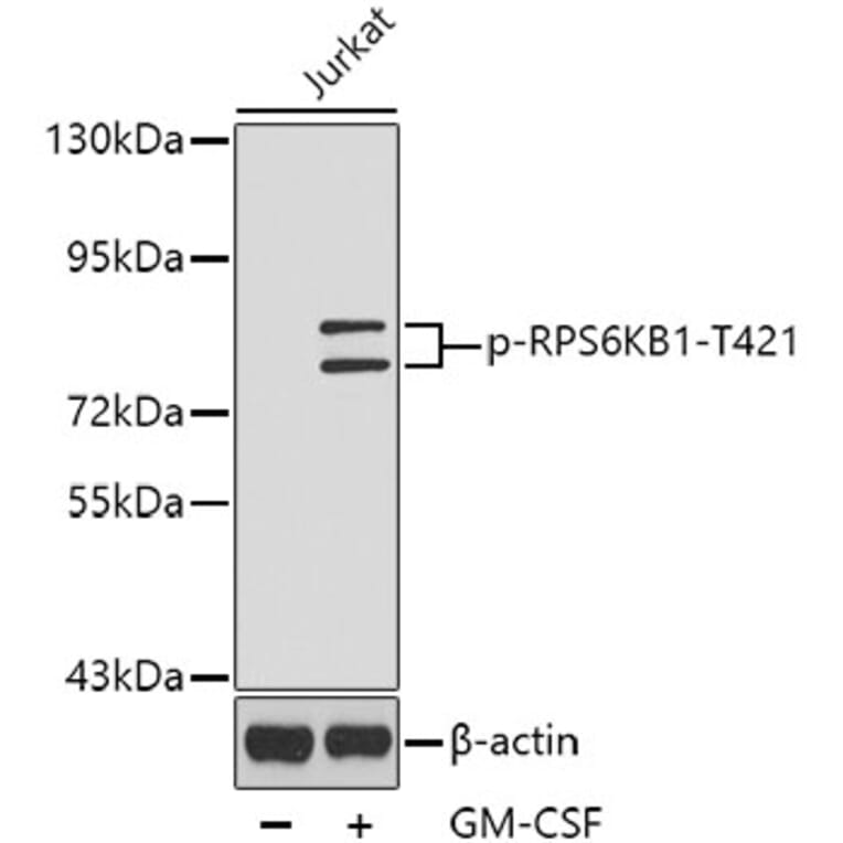 Western Blot - Anti-RPS6KB1 (phospho T421) Antibody (AP0449) - Antibodies.com