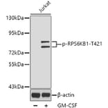 Western Blot - Anti-RPS6KB1 (phospho T421) Antibody (AP0449) - Antibodies.com