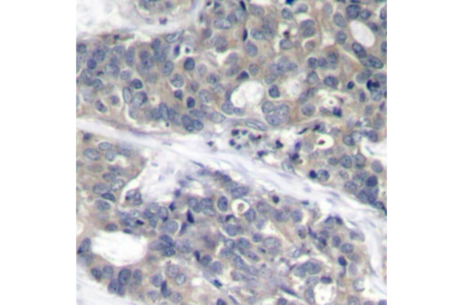 Immunohistochemistry - Anti-RPS6KB1 (phospho T421) Antibody (AP0449) - Antibodies.com