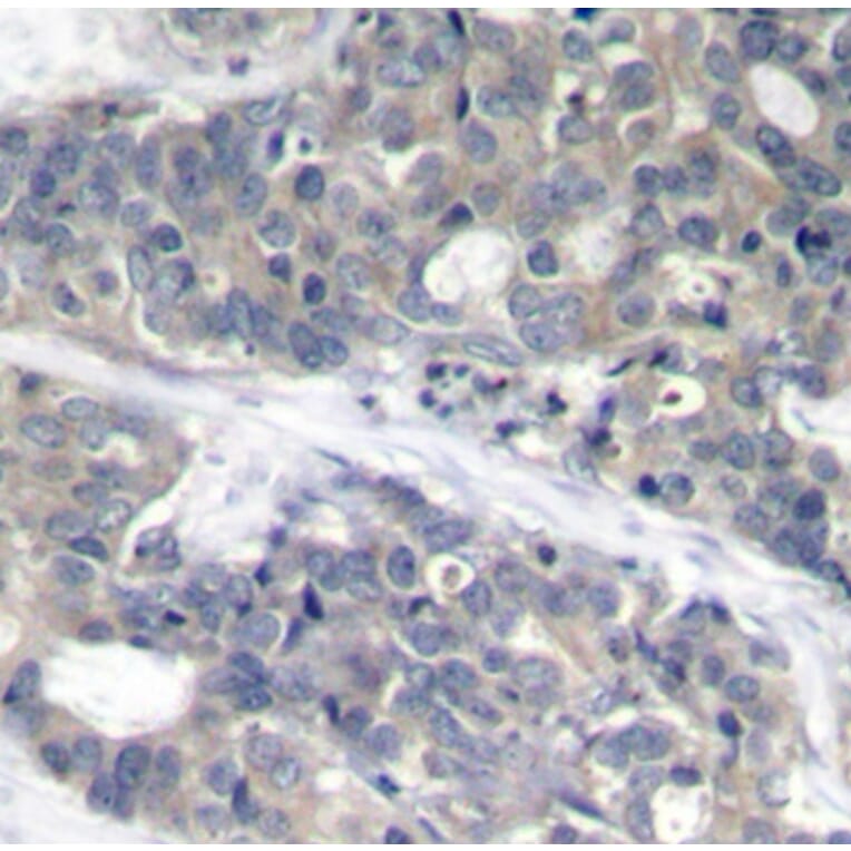 Immunohistochemistry - Anti-RPS6KB1 (phospho T421) Antibody (AP0449) - Antibodies.com