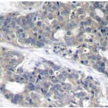 Immunohistochemistry - Anti-RPS6KB1 (phospho T421) Antibody (AP0449) - Antibodies.com