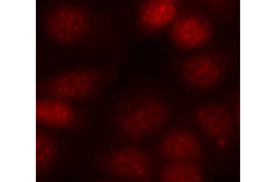 Immunofluorescence - Anti-RPS6KB1 (phospho T421) Antibody (AP0449) - Antibodies.com