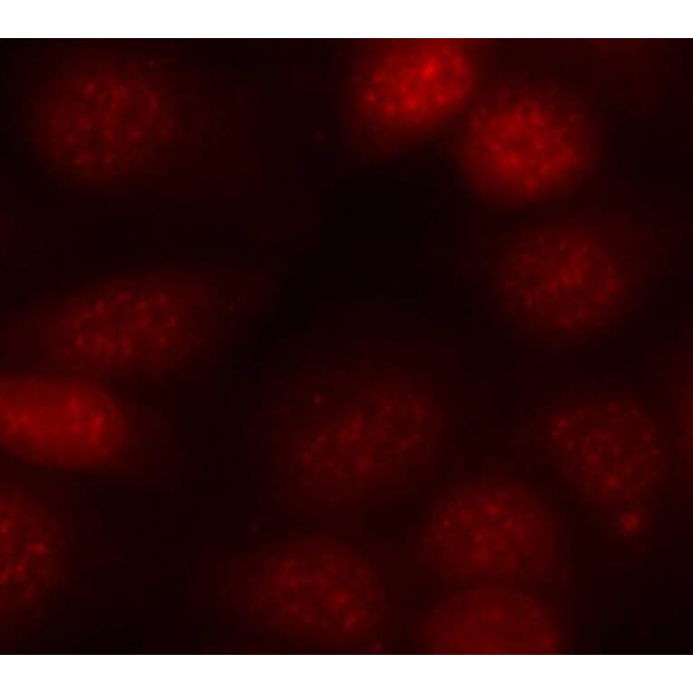 Immunofluorescence - Anti-RPS6KB1 (phospho T421) Antibody (AP0449) - Antibodies.com