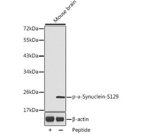 Western Blot - Anti-Alpha-synuclein (phospho Ser129) Antibody (A16666) - Antibodies.com