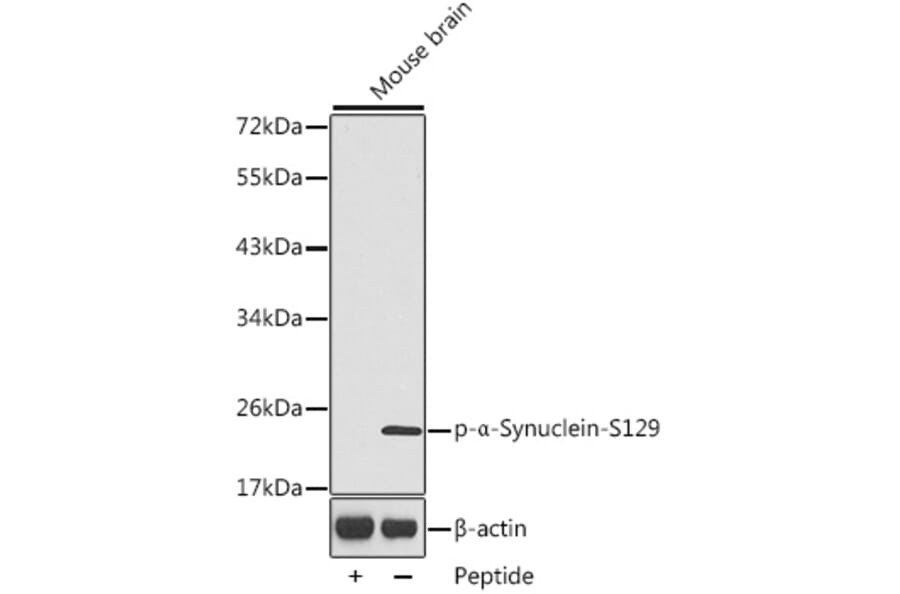 Western Blot - Anti-Alpha-synuclein (phospho Ser129) Antibody (A16666) - Antibodies.com