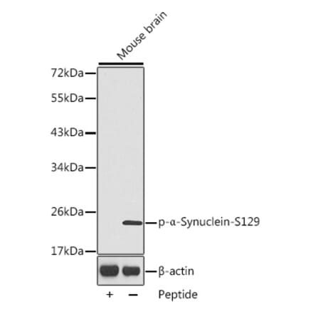 Western Blot - Anti-Alpha-synuclein (phospho Ser129) Antibody (A16666) - Antibodies.com