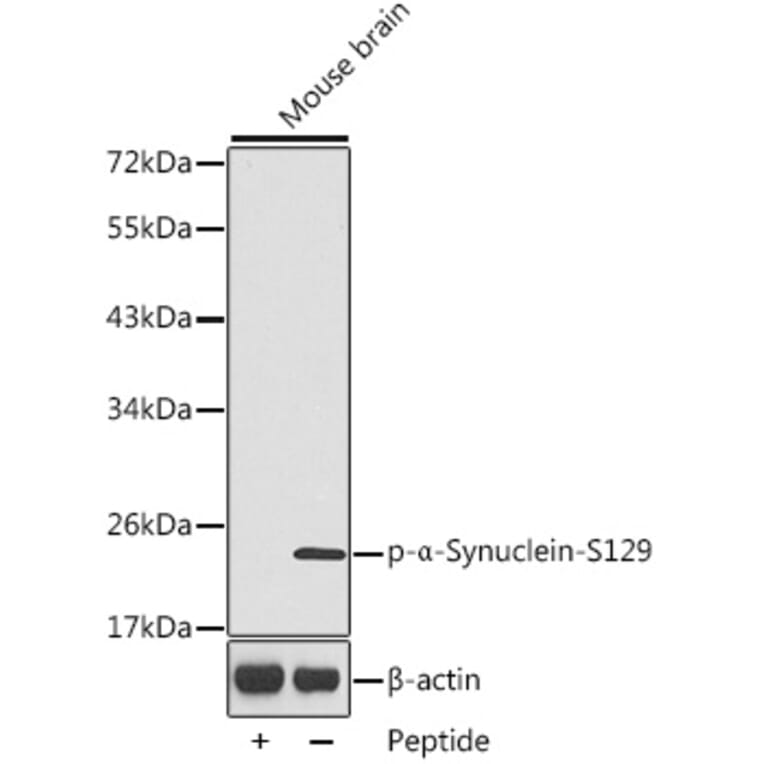 Western Blot - Anti-Alpha-synuclein (phospho Ser129) Antibody (A16666) - Antibodies.com