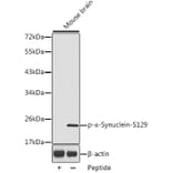 Western Blot - Anti-Alpha-synuclein (phospho Ser129) Antibody (A16666) - Antibodies.com