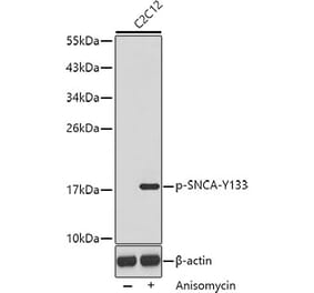 Western Blot - Anti-SNCA (phospho Y133) Antibody (AP0451) - Antibodies.com