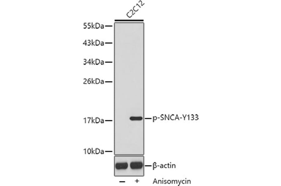 Western Blot - Anti-SNCA (phospho Y133) Antibody (AP0451) - Antibodies.com