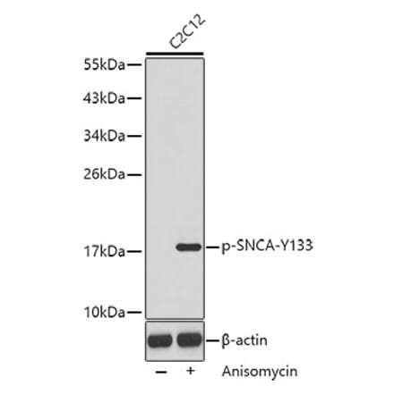 Western Blot - Anti-SNCA (phospho Y133) Antibody (AP0451) - Antibodies.com