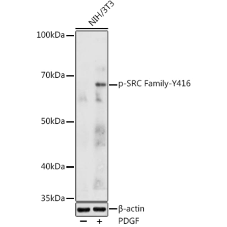 Western Blot - Anti-Src (Phospho Y416) Antibody (A16668) - Antibodies.com