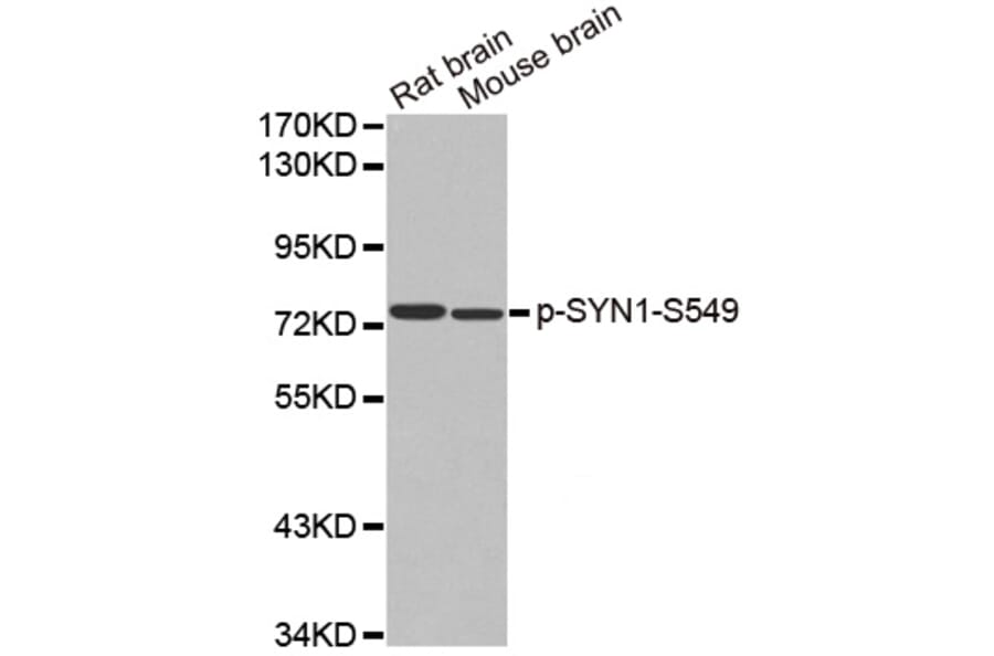 Western Blot - Anti-SYN1 (phospho S549) Antibody (AP0458) - Antibodies.com
