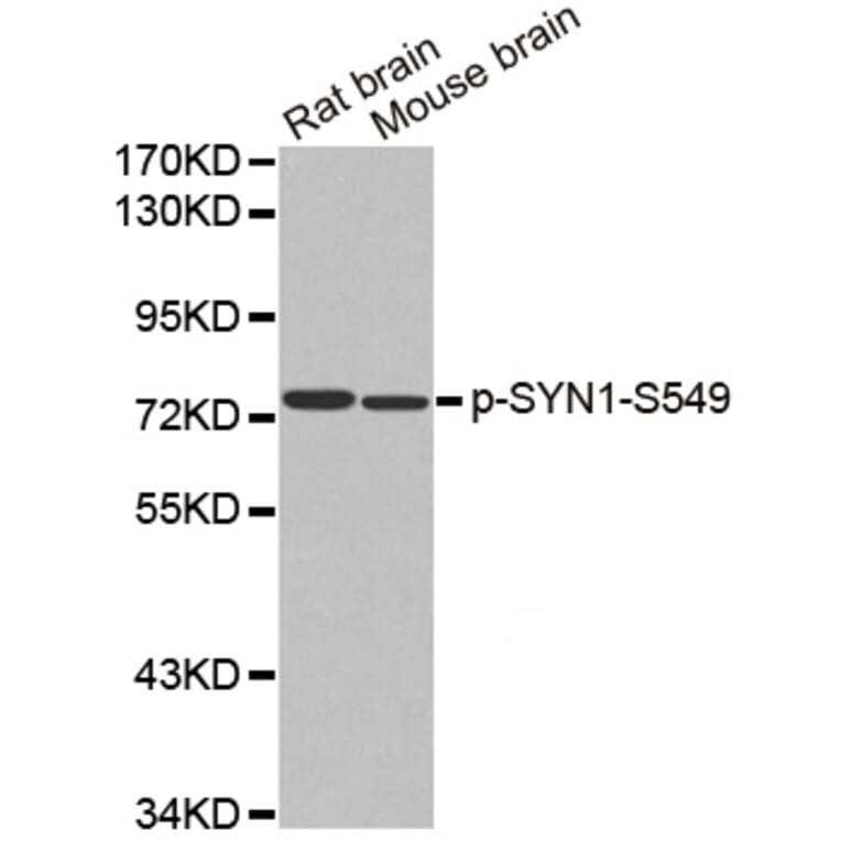 Western Blot - Anti-SYN1 (phospho S549) Antibody (AP0458) - Antibodies.com