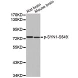 Western Blot - Anti-SYN1 (phospho S549) Antibody (AP0458) - Antibodies.com