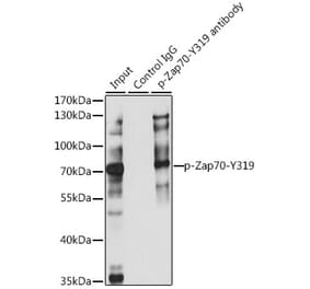 Western Blot - Anti-ZAP70 (phospho Tyr319) Antibody (A16674) - Antibodies.com