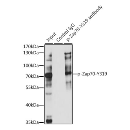 Western Blot - Anti-ZAP70 (phospho Tyr319) Antibody (A16674) - Antibodies.com
