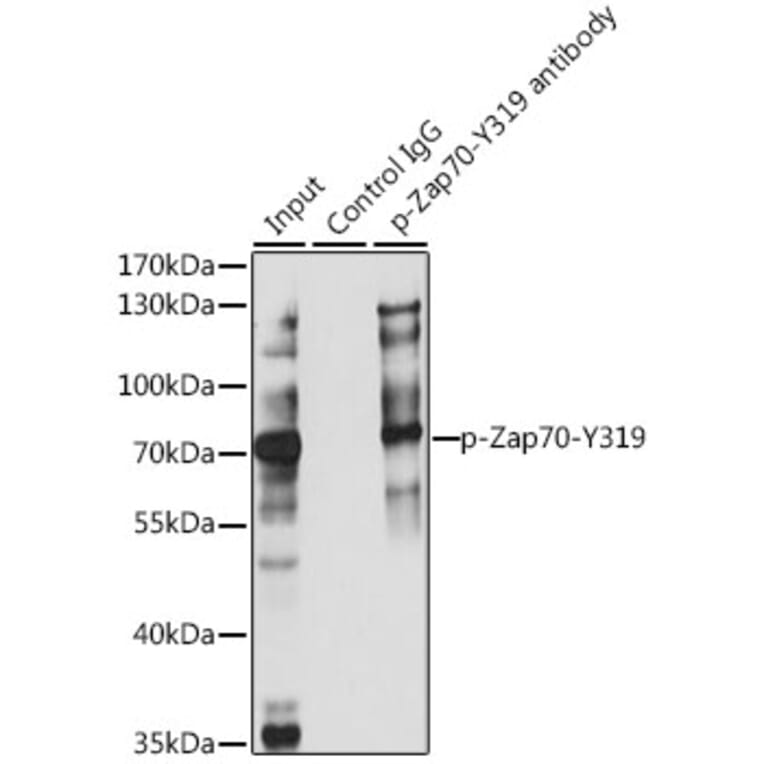Western Blot - Anti-ZAP70 (phospho Tyr319) Antibody (A16674) - Antibodies.com